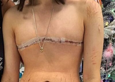¿Cómo voy a salir de esto? Detransicionadoras abandonadas por las comunidades médicas y trans