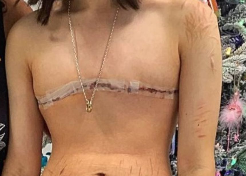 ¿Cómo voy a salir de esto? Detransicionadoras abandonadas por las comunidades médicas y trans