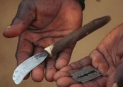 Los hombres no pueden sufrir mutilación genital femenina