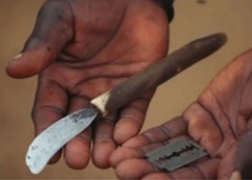 Los hombres no pueden sufrir mutilación genital femenina