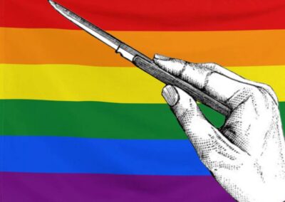 Irán. Cirugías trans para conversión de homosexuales